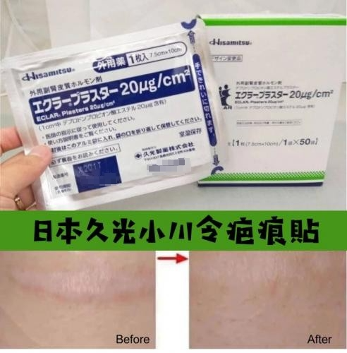 1769129981446845.png 日本 久光製藥 小川令疤痕貼(單片) -(長期團)-1.png